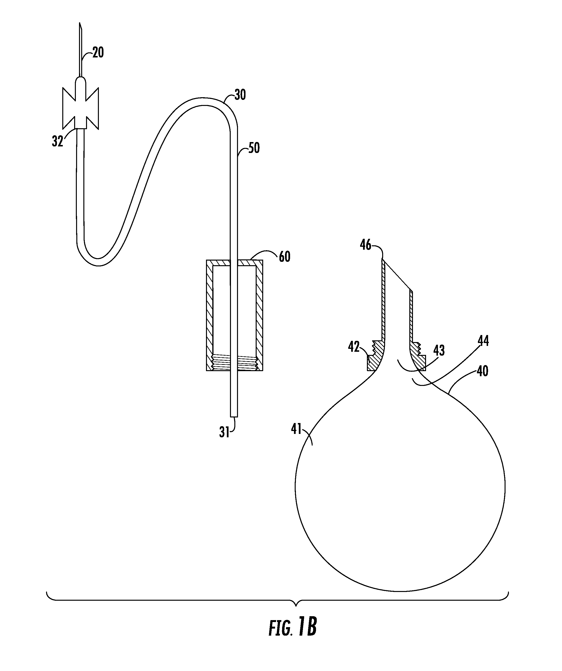 Apparatus and method for breast reconstruction and augmentation using an autologous platelet-rich fibrin matrix