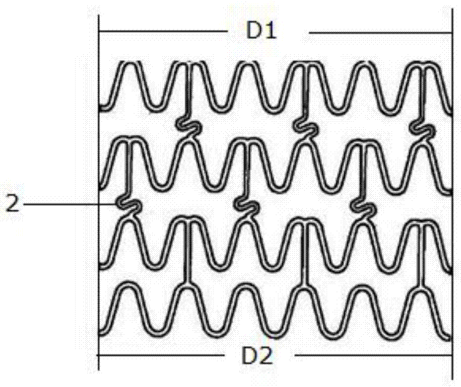 Gradual changed thickness coronary stent suitable for coronary artery tortuosity angulation lesion