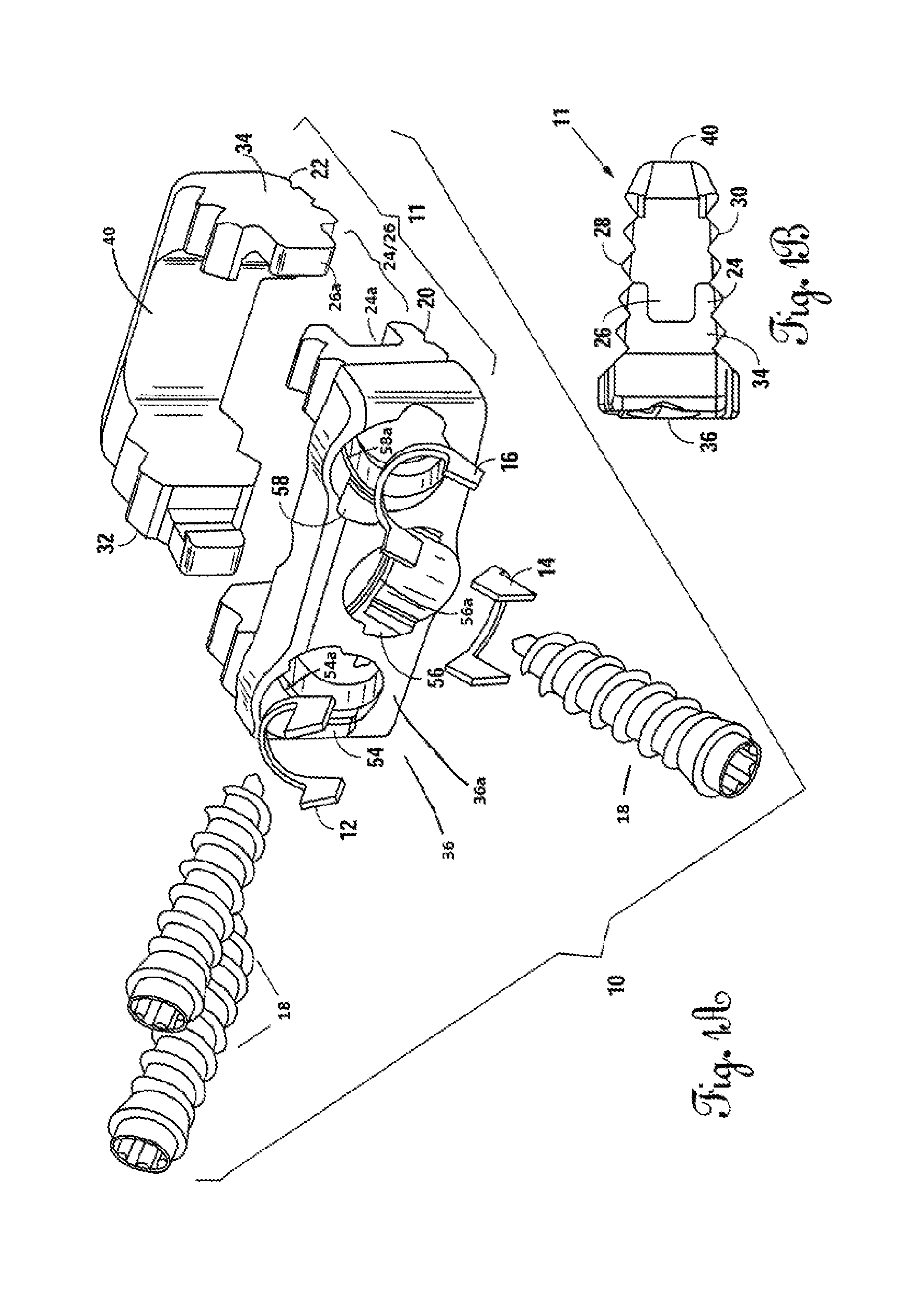 Low profile standalone cervical interbody with screw locking clips and method of using same