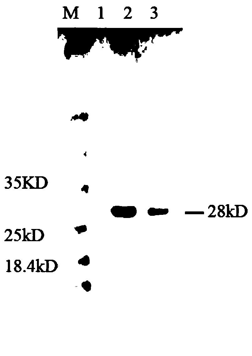 Detection kit for TIMP-I latex enhanced turbidimetry and preparation and using method thereof