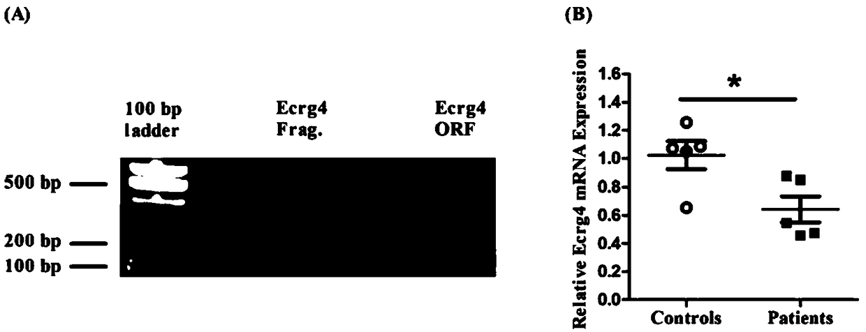 Exosome containing ECRG4 mRNA and preparation method and application of exosome