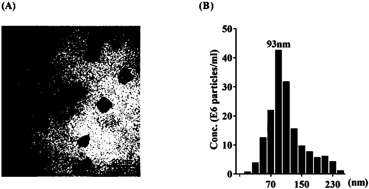 Exosome containing ECRG4 mRNA and preparation method and application of exosome