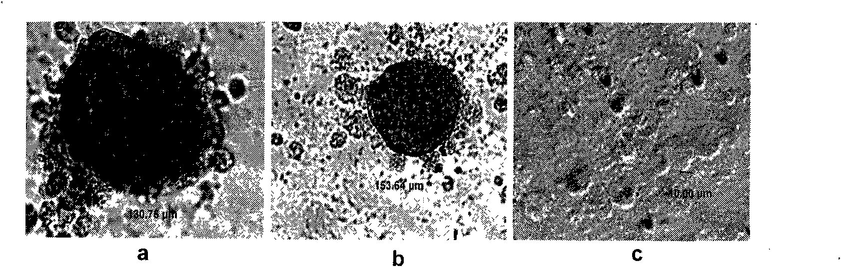 Method for inducing in vitro human medulla mesenchymal stem cells to be divided into islet-like cells