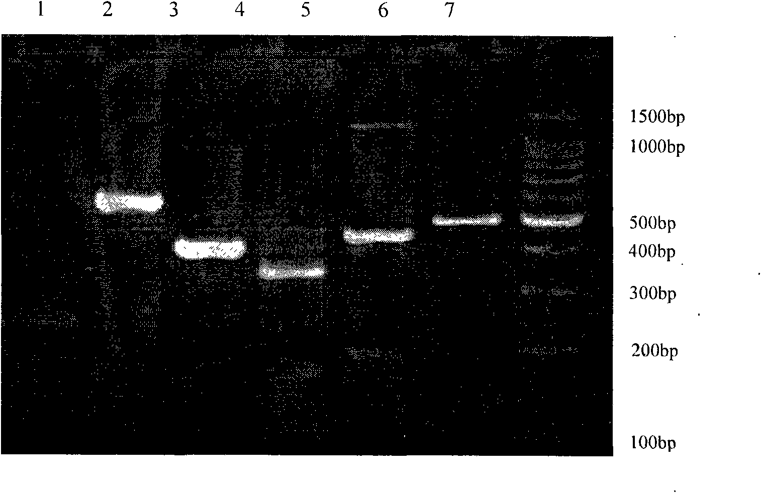 Method for inducing in vitro human medulla mesenchymal stem cells to be divided into islet-like cells