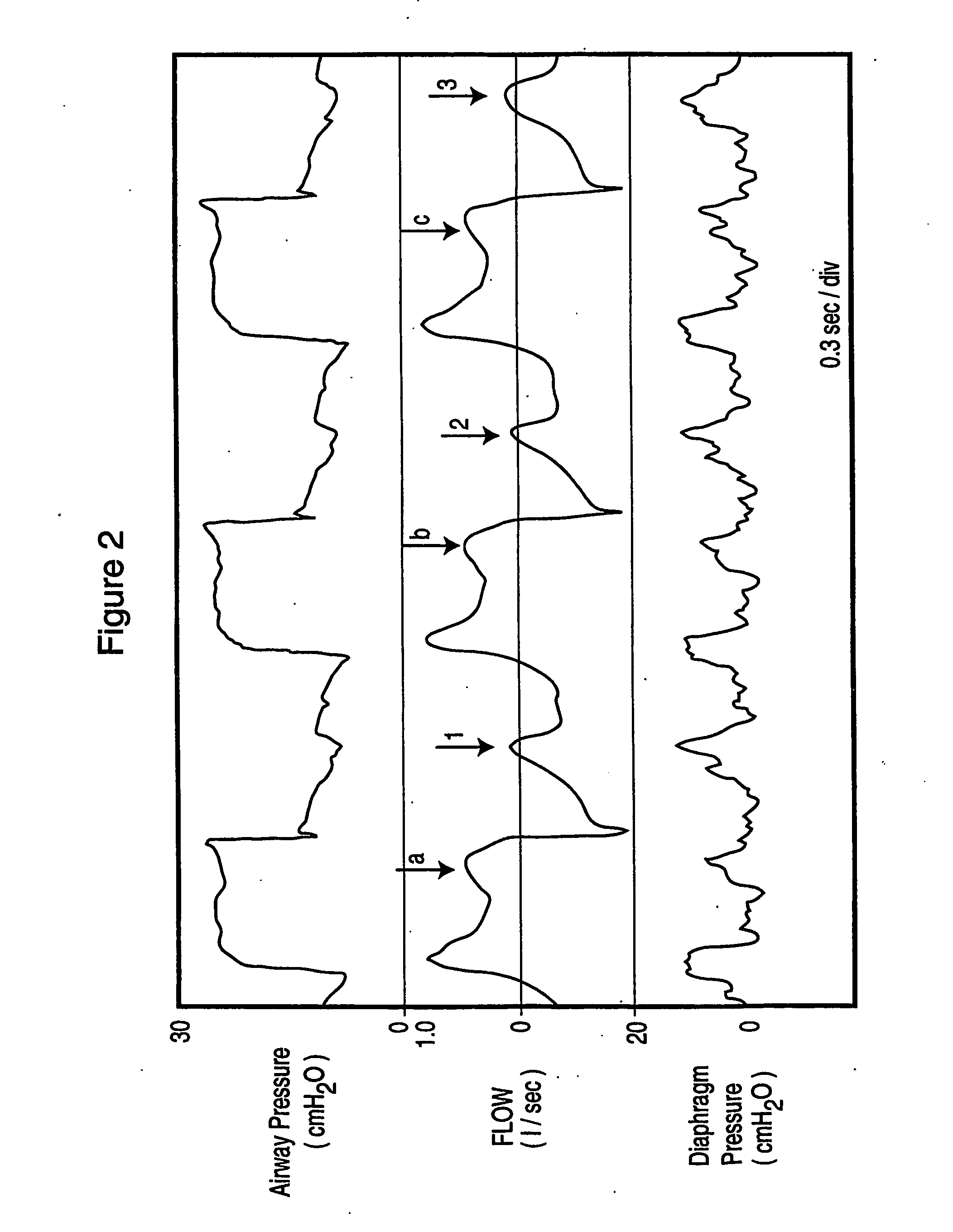 Method and device for monitoring and improving patient-ventilator interaction