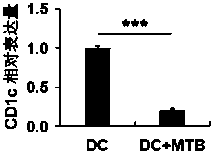 Application of cd1c in the diagnosis of bacterial-negative pulmonary tuberculosis