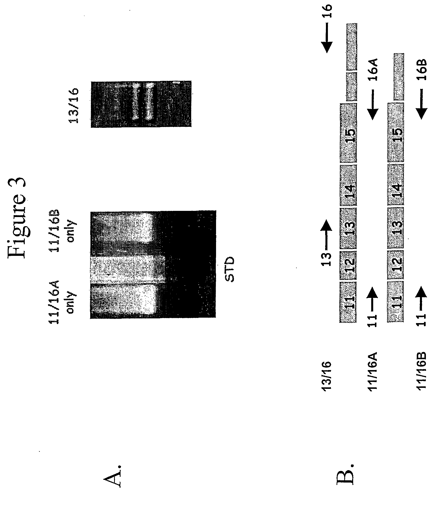 Method of diagnosing and treating cancer using b-catenin splice variants
