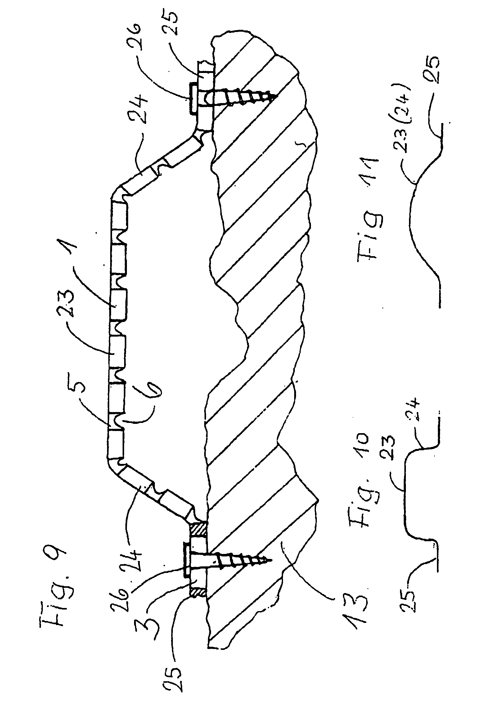 Device for regenerating, repairing, and modeling human and animal bone, especially in the jaw area for dental applications