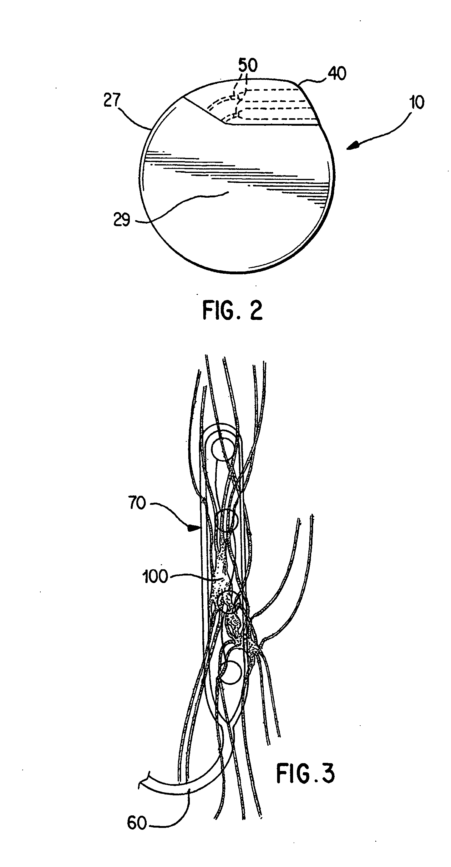 Nerve stimulation for treatment of syncope