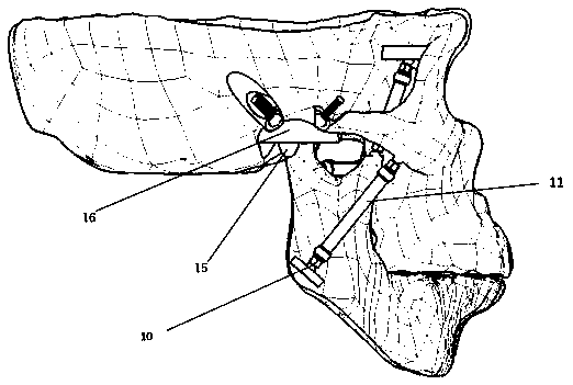 Bionic chewing motion mechanism with double Hooker hinges