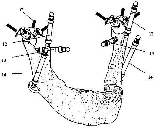 Bionic chewing motion mechanism with double Hooker hinges