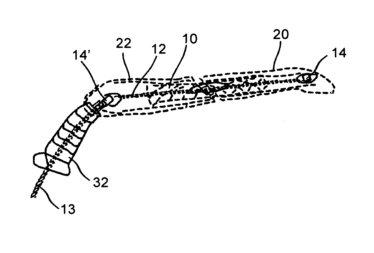 Implant for long bones and treatment method
