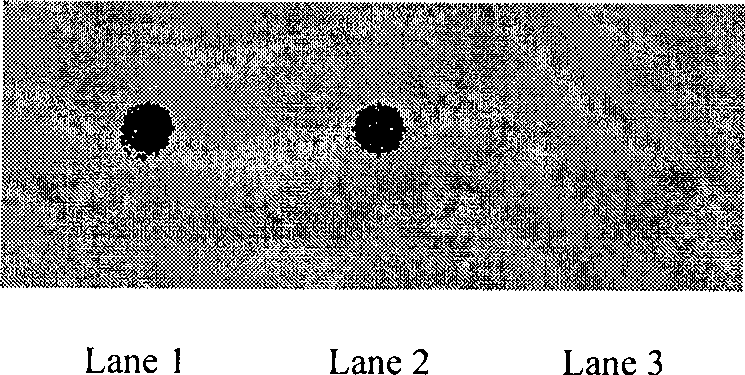 Reagent kit for detecting obstruction performance and non-obstruction performance non-spermatozoa symptom based on Eppin antibody