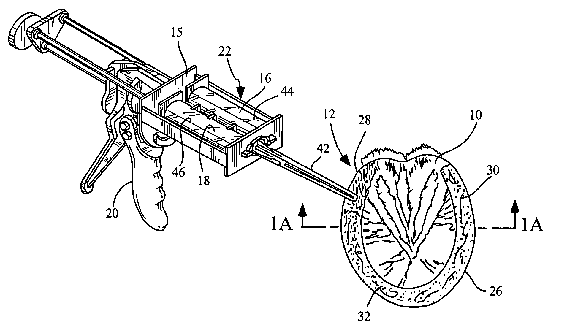 Method and apparatus for in situ and molded horseshoeing