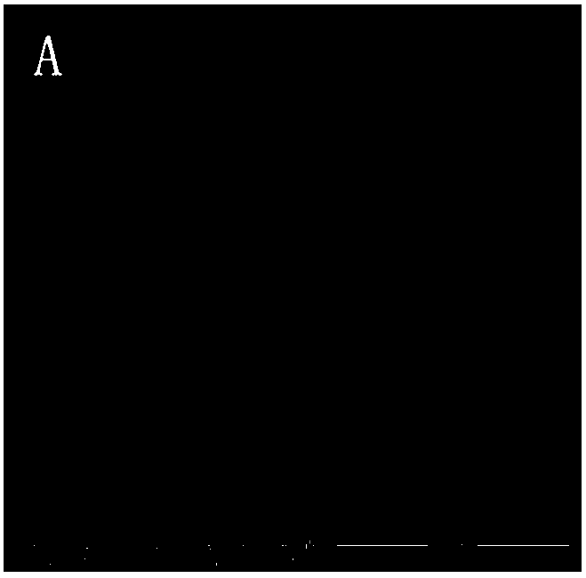 Surface treatment method for sclerotic dentin