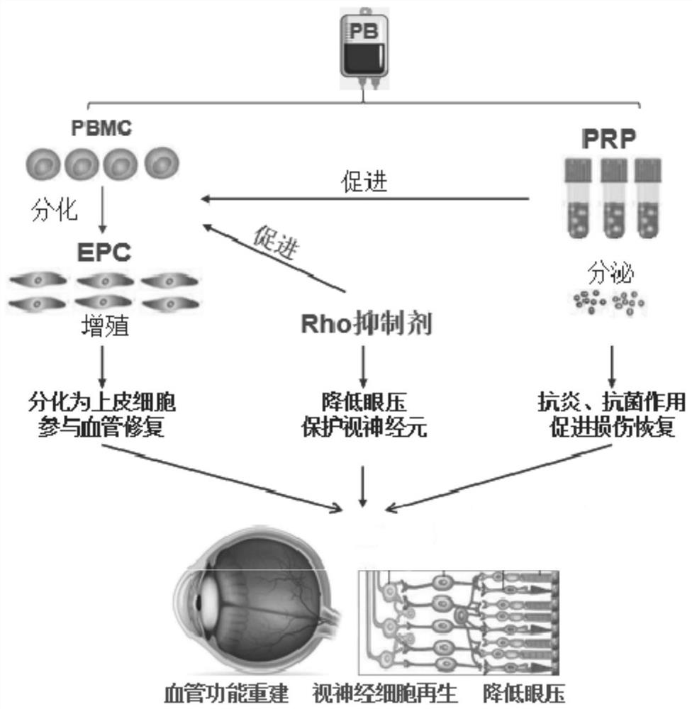 Optic nerve repair composition as well as preparation method and application thereof