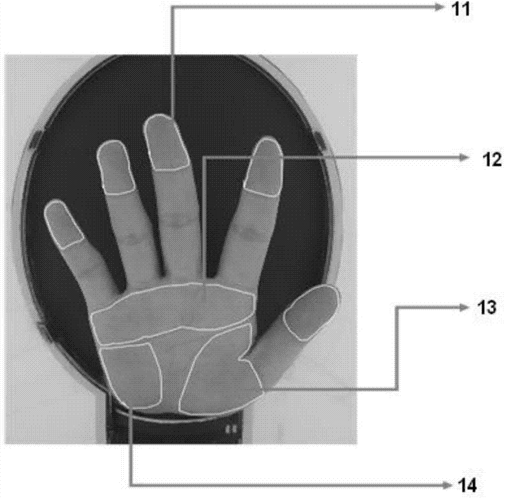 Palm color analysis method for health status identification