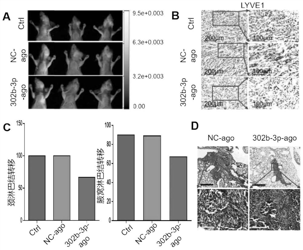 Application of miR-302b-3p as anti-tumor marker of oral squamous cell carcinoma