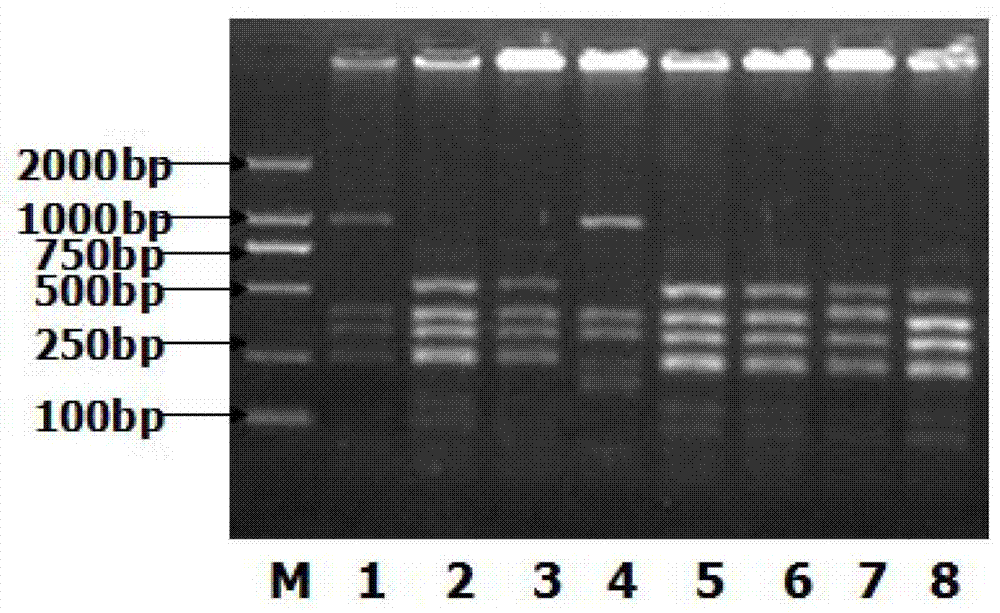 Mycoplasma pneumonia P1-RFLP gene typing and detecting primer and method