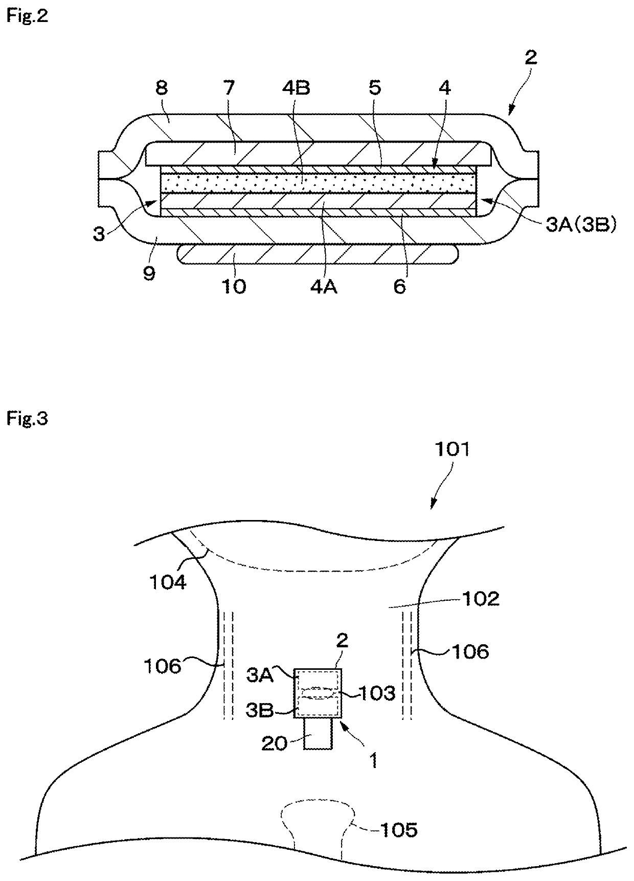 Swallowing sensor