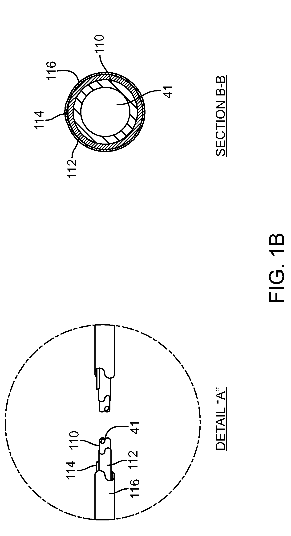 Irreversible electroporation device and method for attenuating neointimal