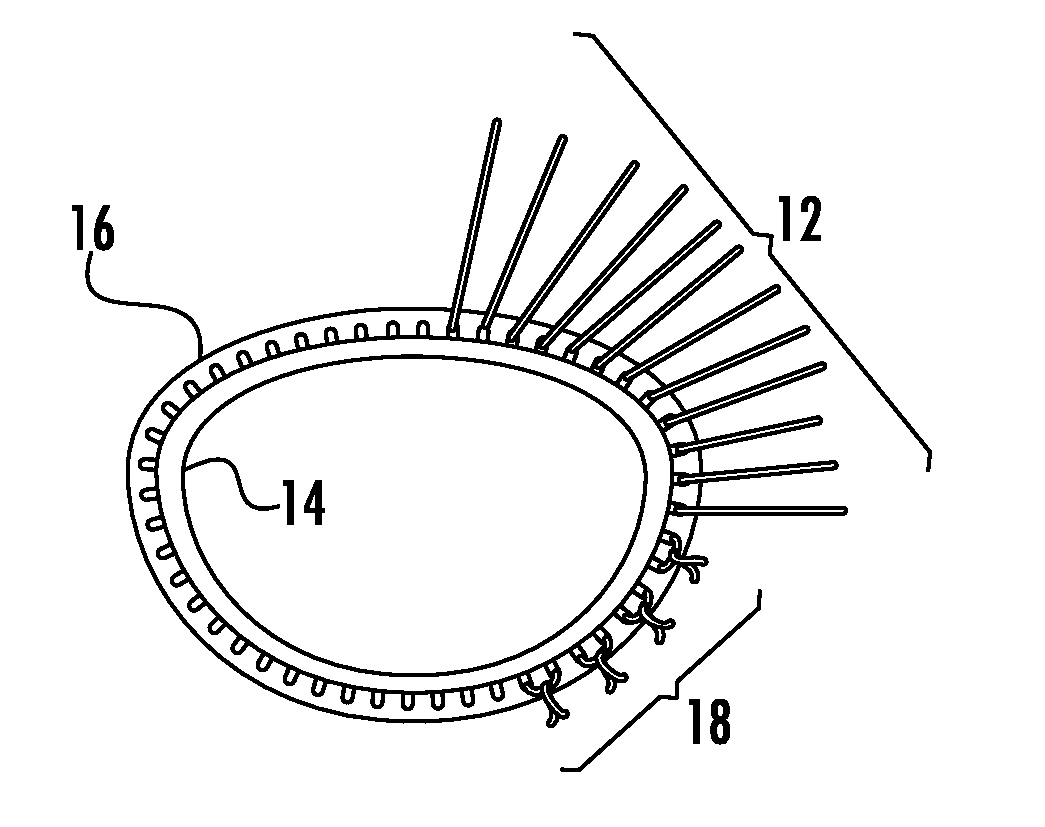 Prosthetic device for heart valve reinforcement and remodeling procedures