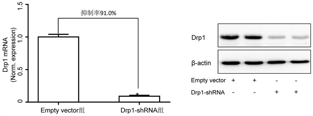 A method for constructing bone marrow cell drp1 gene-specific knockdown mouse model