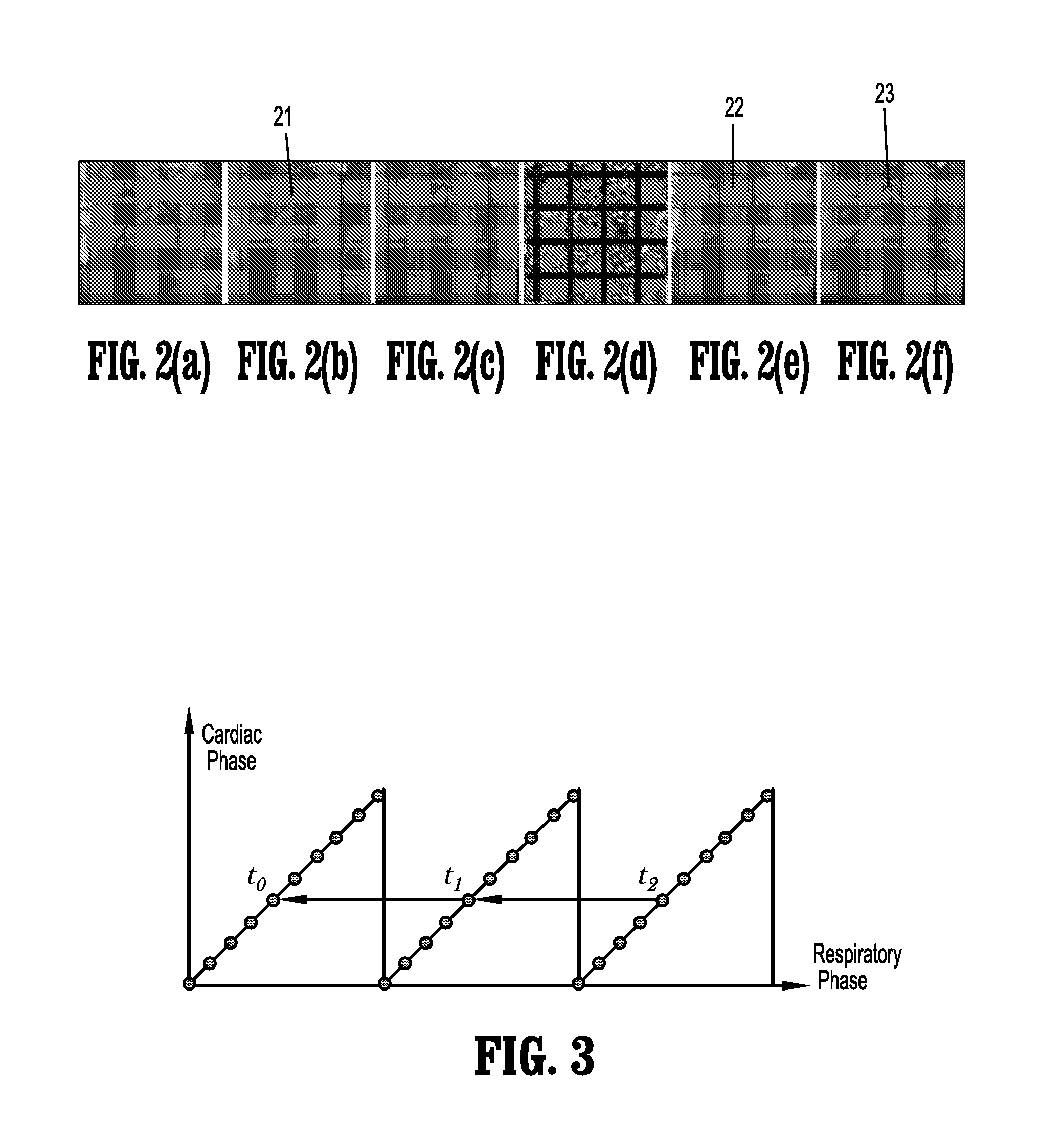 System and method for image-based respiratory motion compensation for fluoroscopic coronary roadmapping