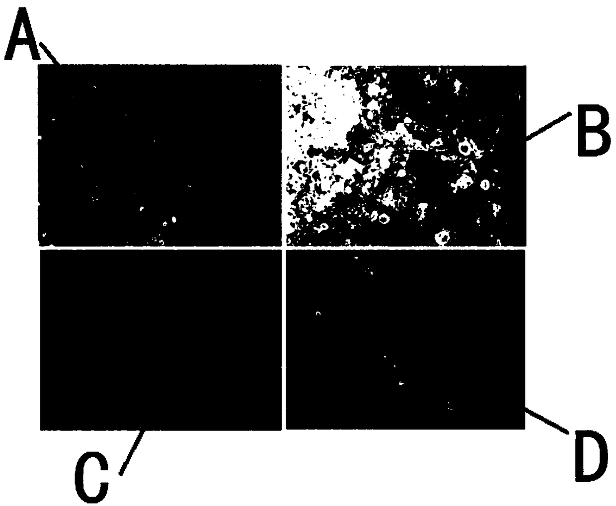 Cell culture solution and establishment method of human primary lung cancer cell line