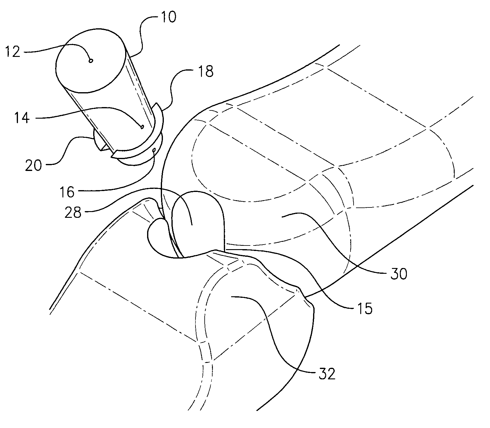 Spinal plug for a minimally invasive facet joint fusion system