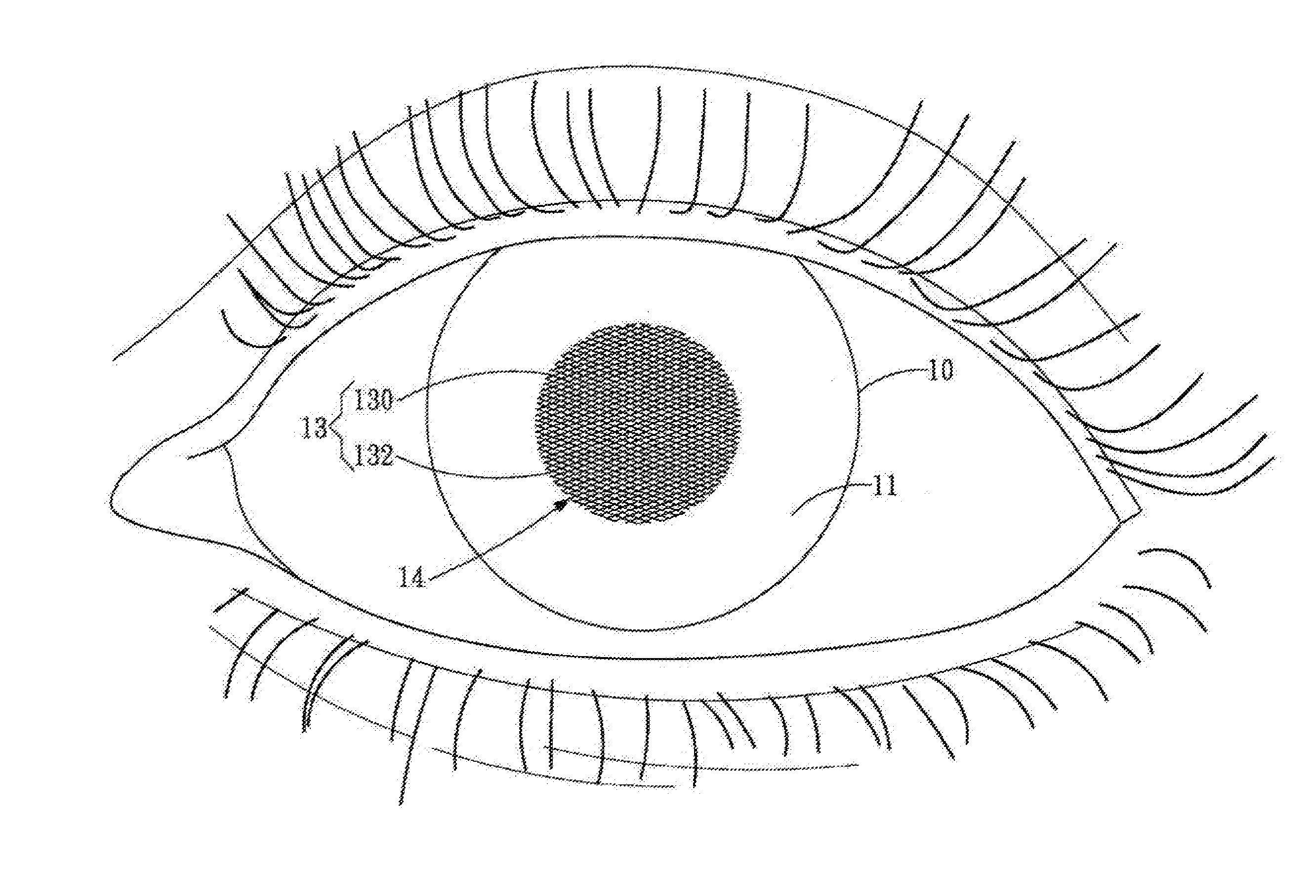 System and method for monitoring change of intraocular pressure and contact lens for sensing change of intraocular pressure