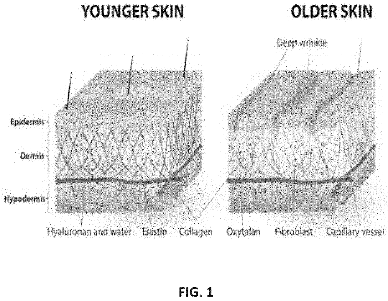 Method of skin rejuvenation using stem cell engraftment