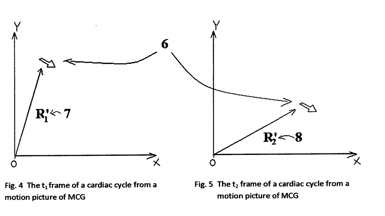 Calibration of two synchronized motion pictures from magnetocardiography and echocardiography