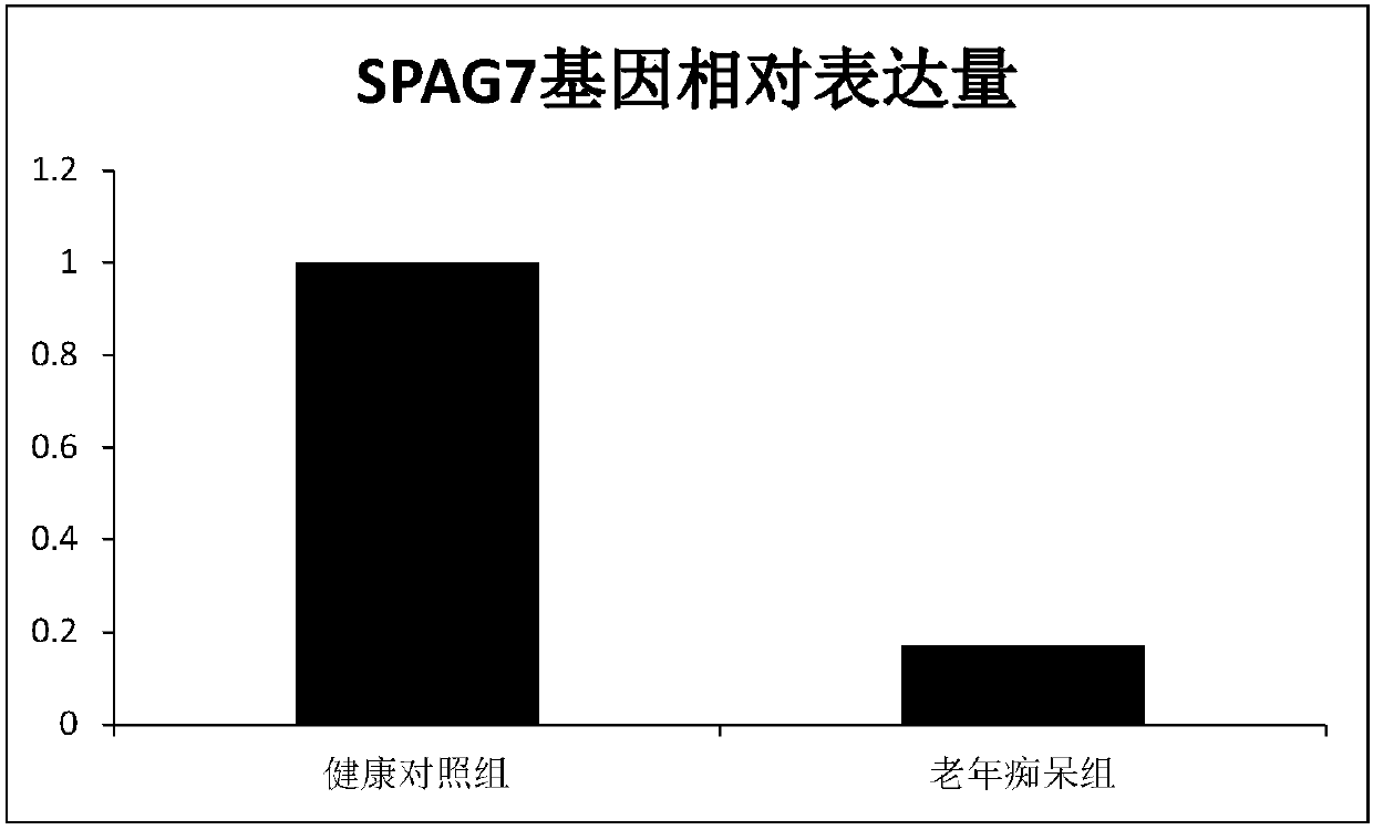 Application of SPAG7 (Sperm Associated Antigen) gene in preparing senile dementia diagnosis kit