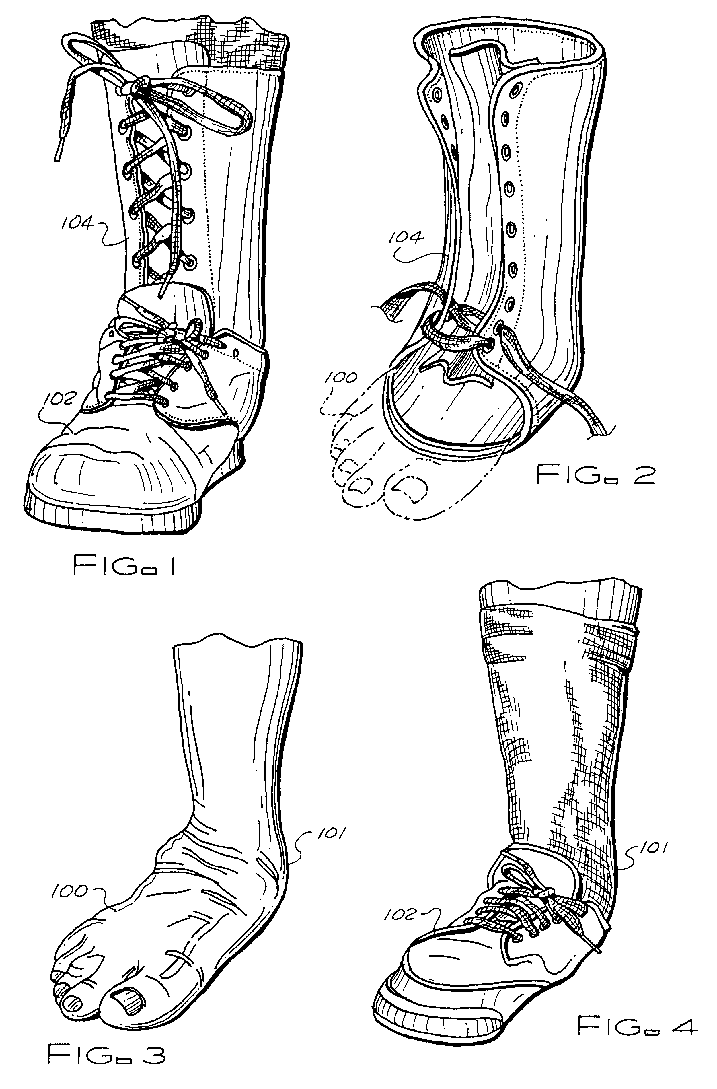 Custom ankle brace system