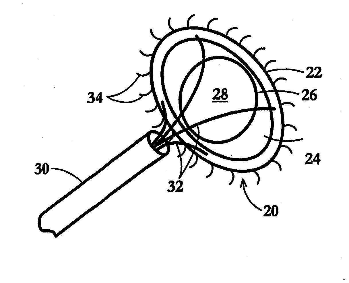 Device and Method for Temporary or Permanent Suspension of an Implantable Scaffolding Containing an Orifice for Placement of a Prosthetic or Bio-Prosthetic Valve