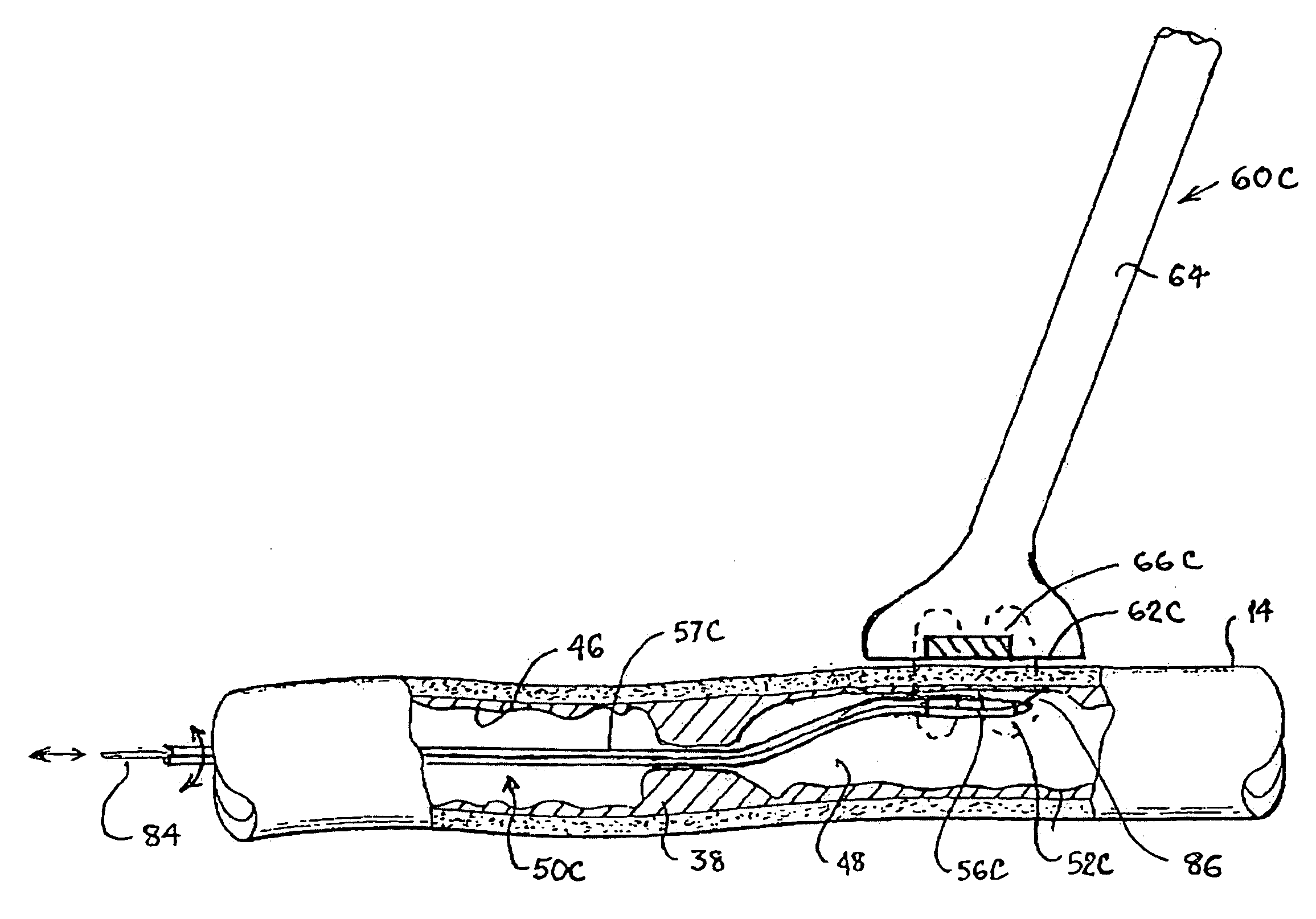 Methods and Apparatus for Locating Body Vessels and Occlusions in Body Vessels