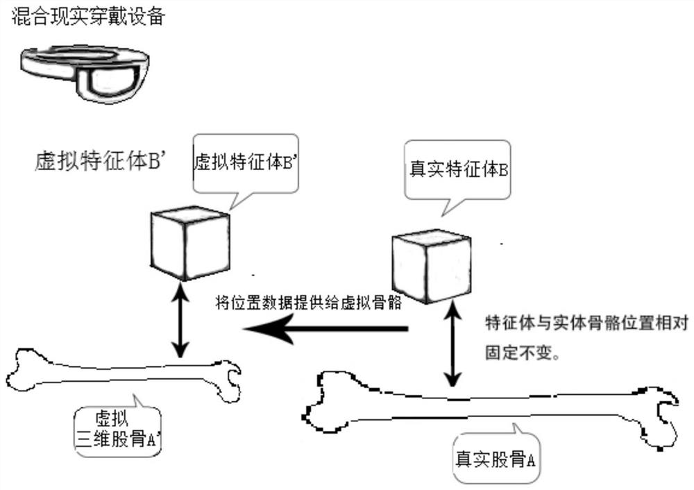 Display and registration method for total knee arthroplasty