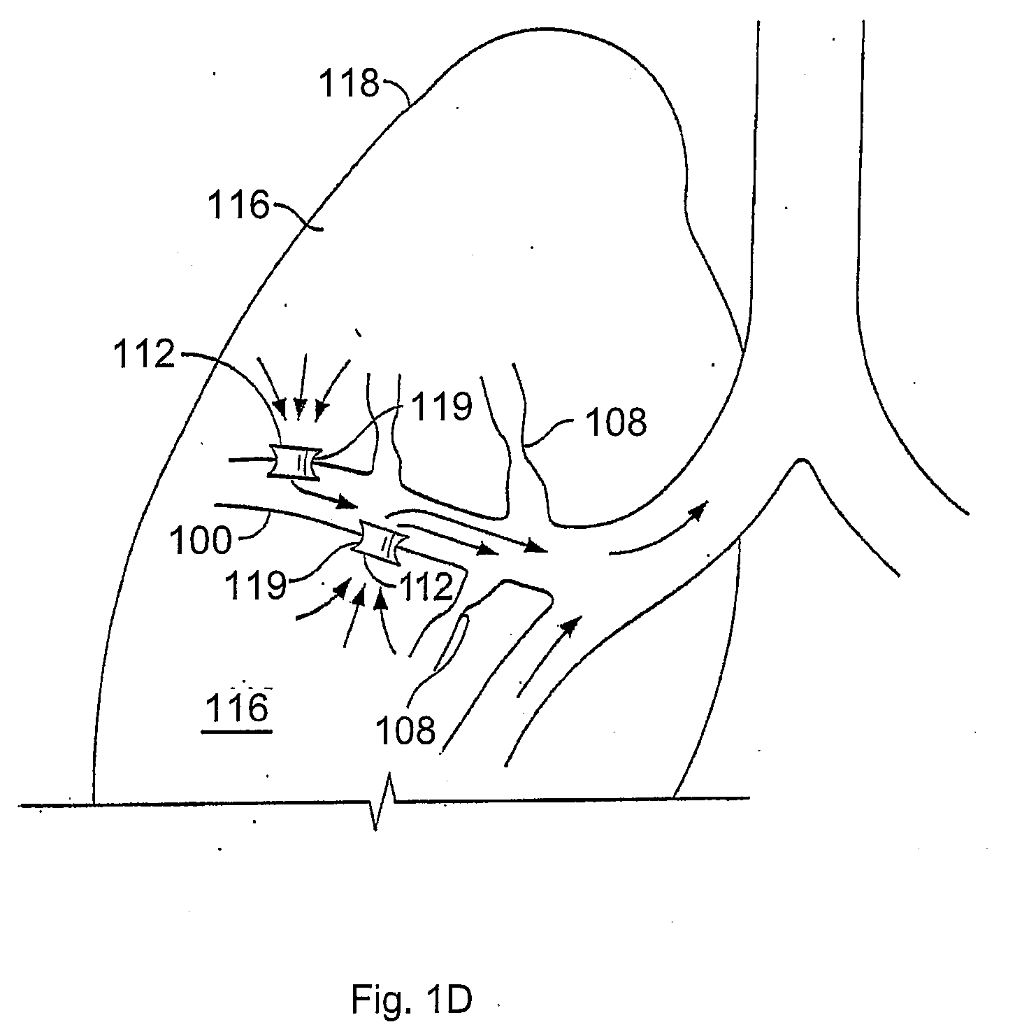 Devices for creating passages and sensing for blood vessels