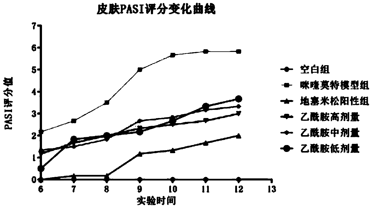 Application of acetamide in anti-psoriasis drugs