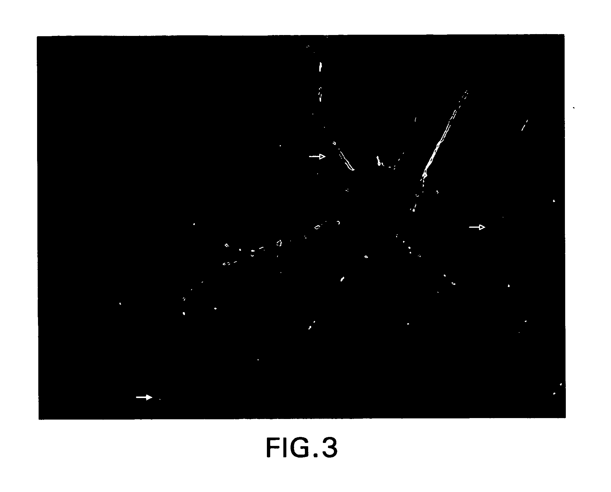 Receptor for amyloid beta and uses thereof
