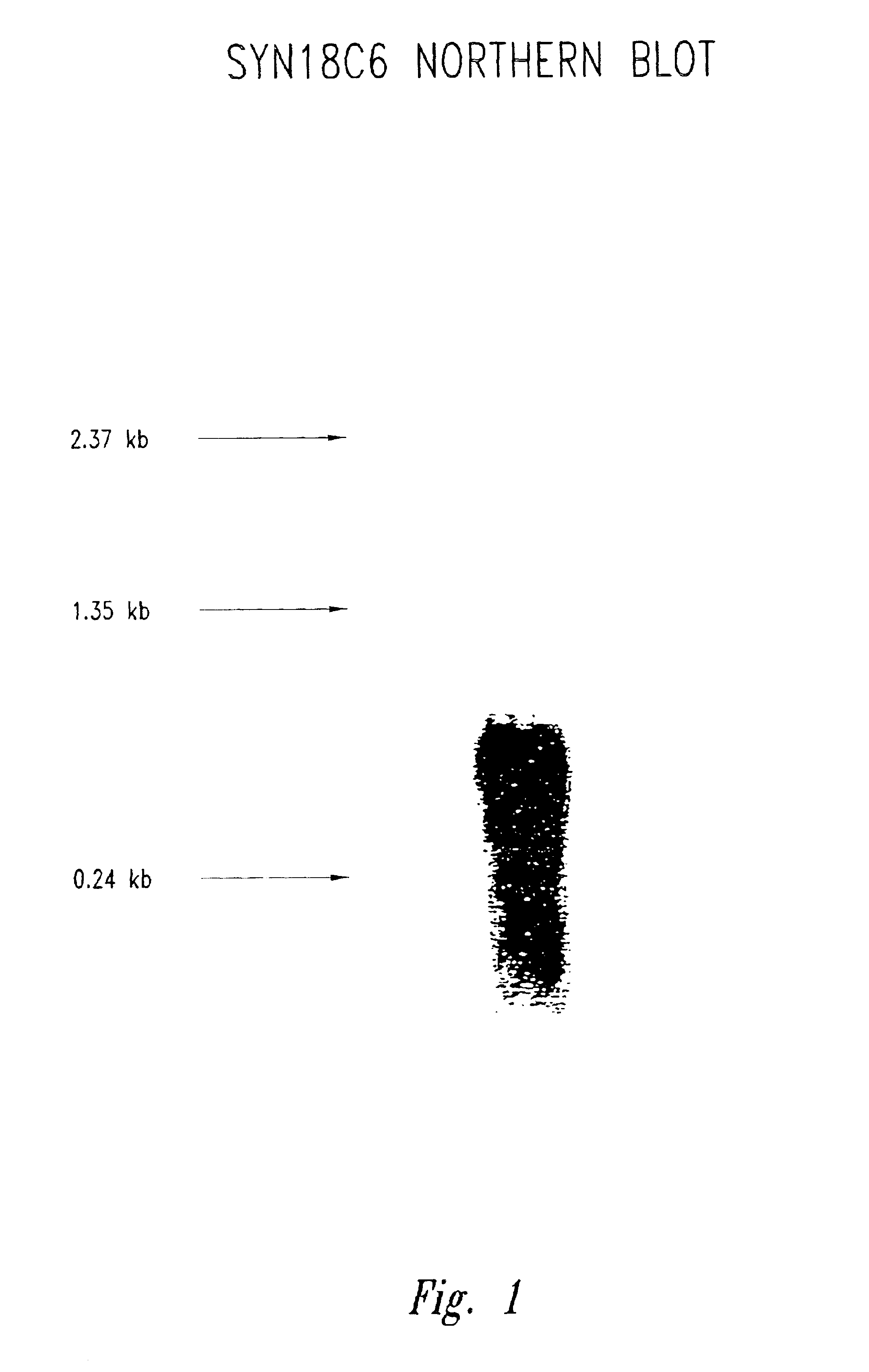 Compositions and methods for the therapy and diagnosis of breast cancer