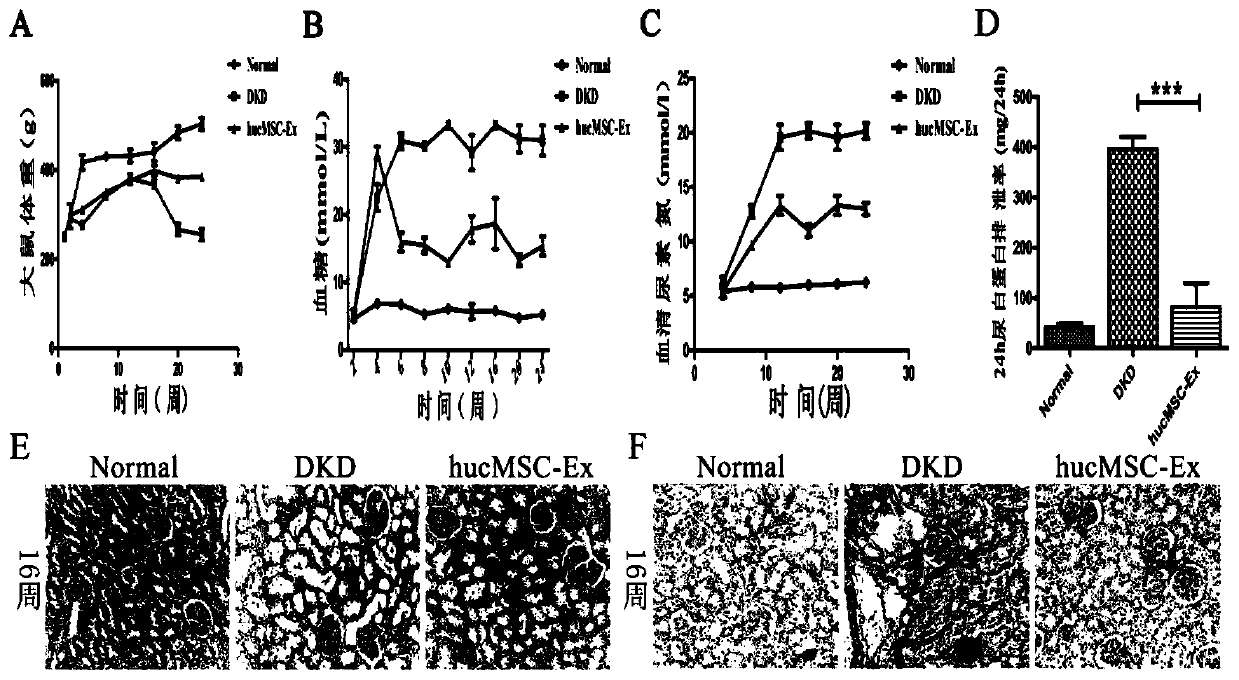 Novel biological preparation for resisting renal fibrosis, of human umbilical cord MSC exosome and preparation method