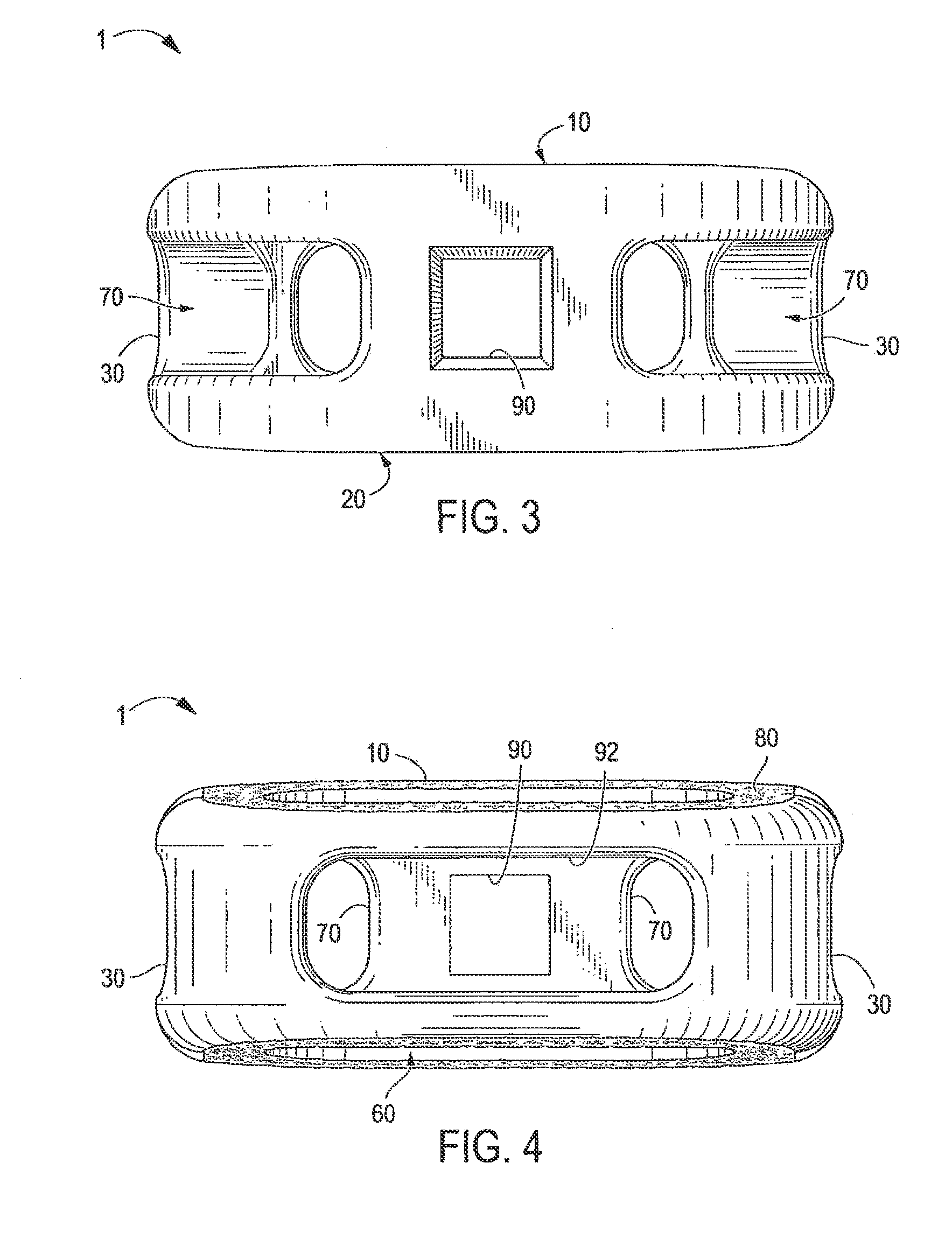 Implant with critical ratio of load bearing surface area to central opening area