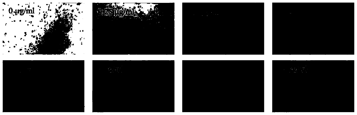 Method for rapidly obtaining bacterial drug resistance by detecting number of bacteria on gel