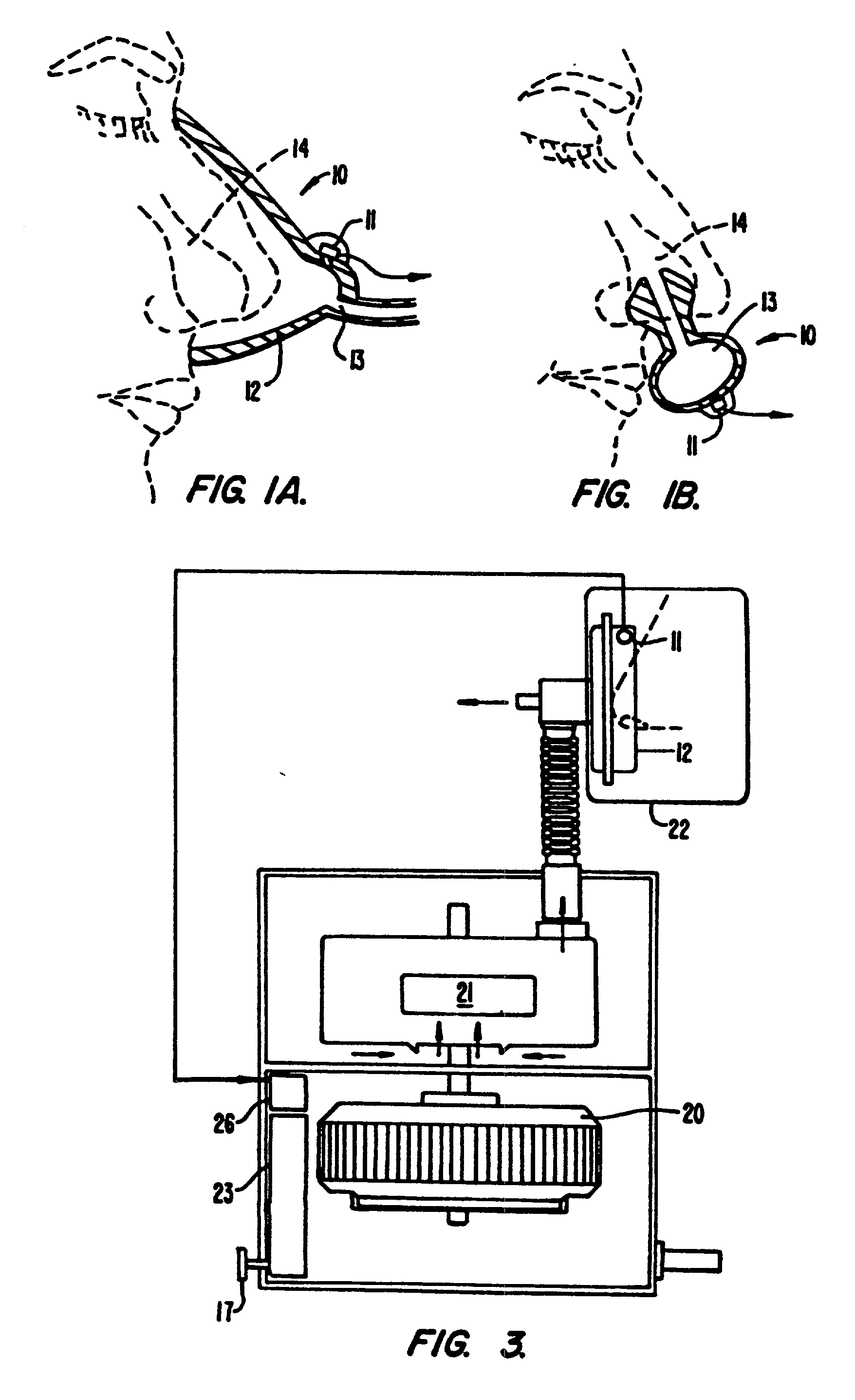 Method and apparatus useful in the diagnosis of obstructive sleep apnea of a patient