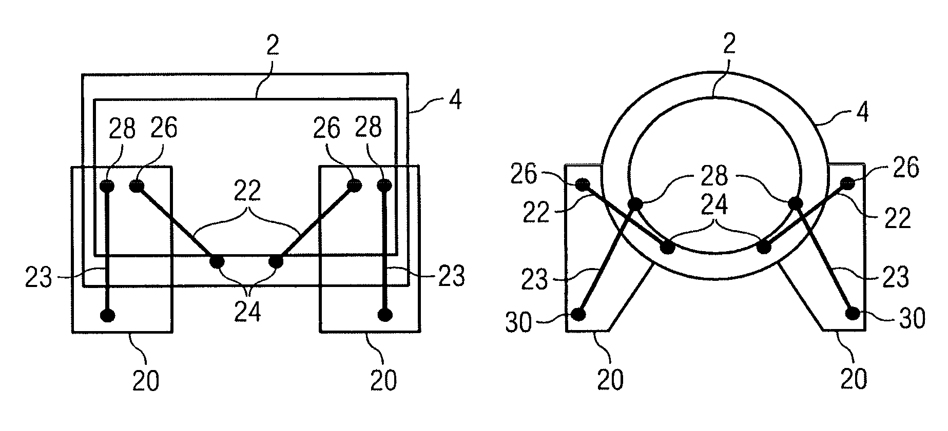 Cryostat comprising a cryogen vessel suspended within an outer vacuum container