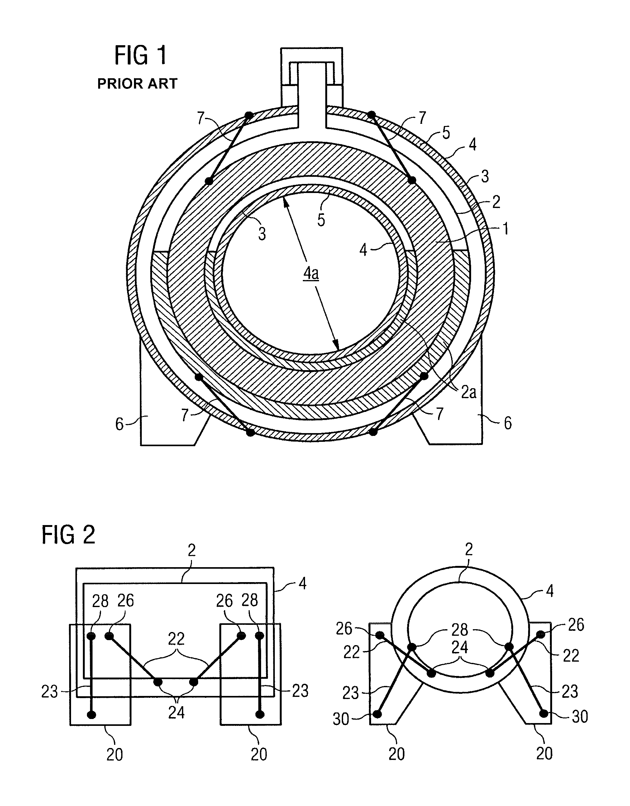 Cryostat comprising a cryogen vessel suspended within an outer vacuum container