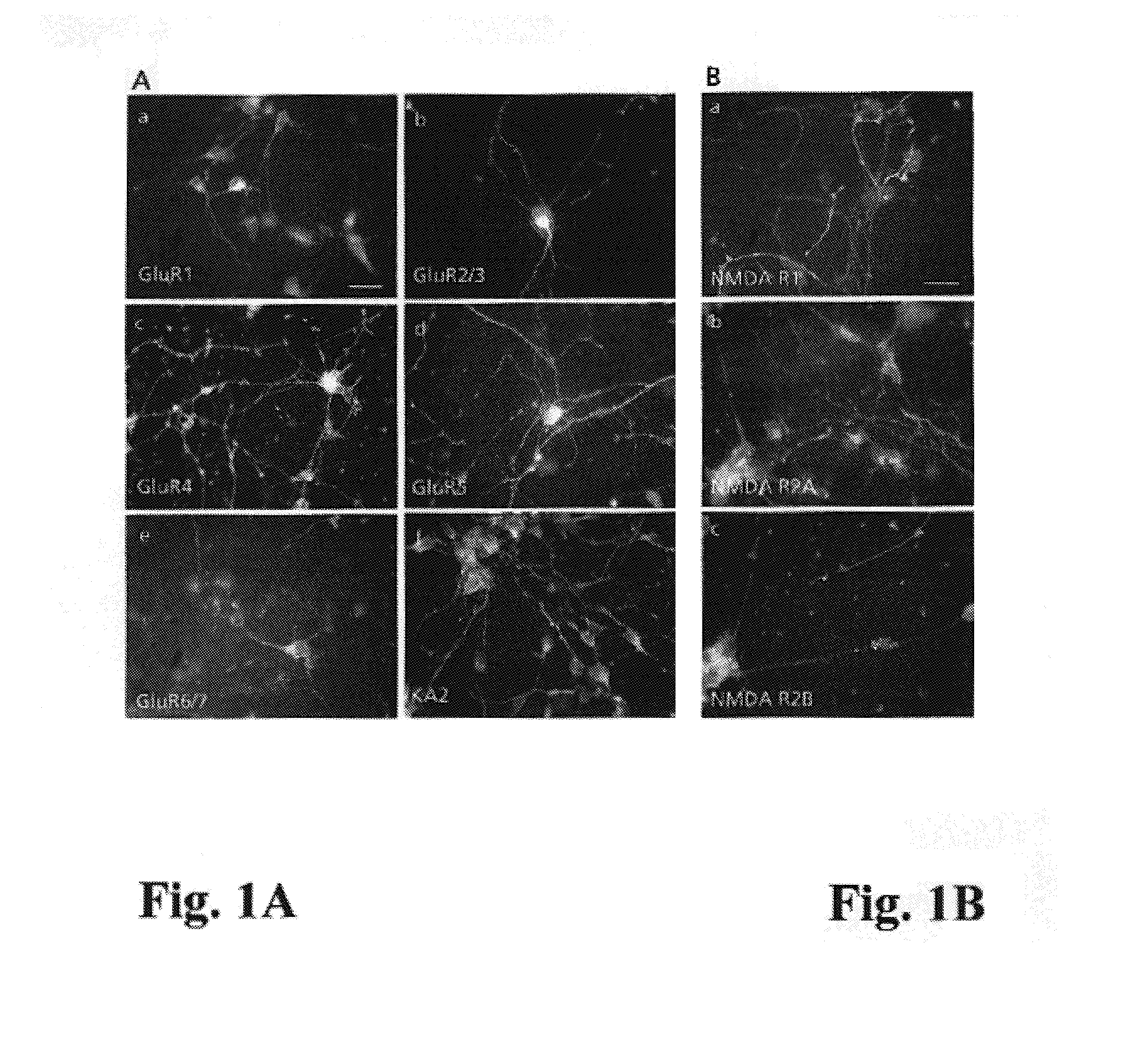 Methods of inhibiting glutamate receptors by administering the tripeptide KDI