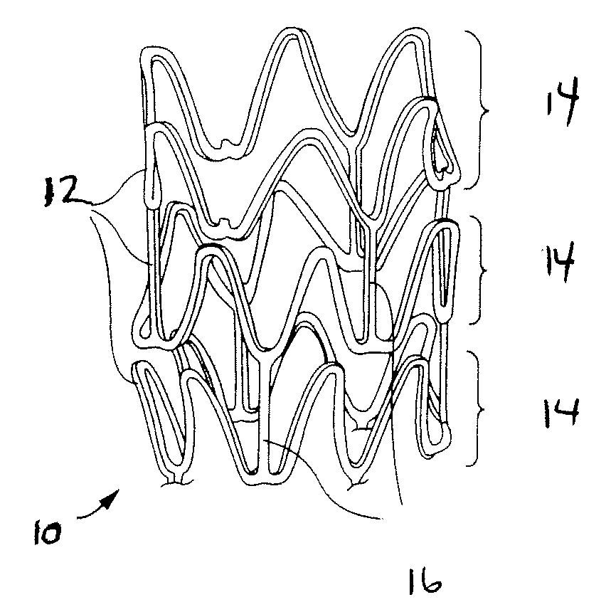 Stent and method for making a stent